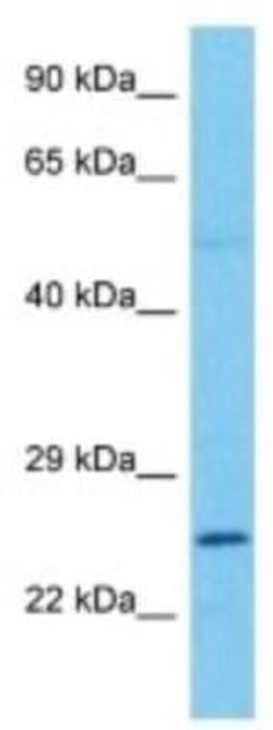 Connexin 26/GJB2 Rabbit anti-Mouse, Polyclonal, Novus Biologicals:Antibodies:Primary